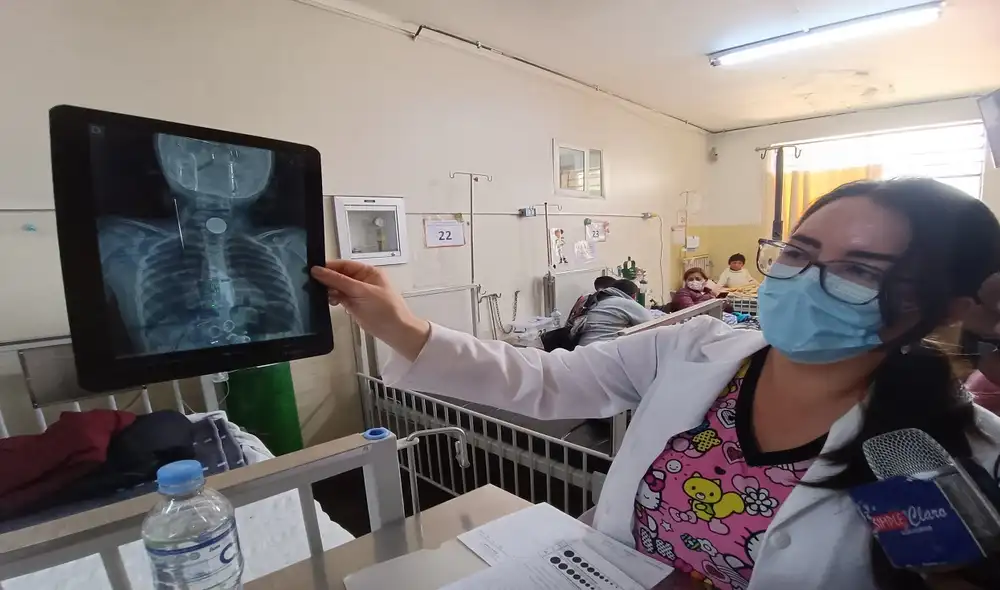 Objeto extraño quedó atrapado en el esófago de la menor, lo que le provocó falta de respiración. Foto: Luis Álvarez LR