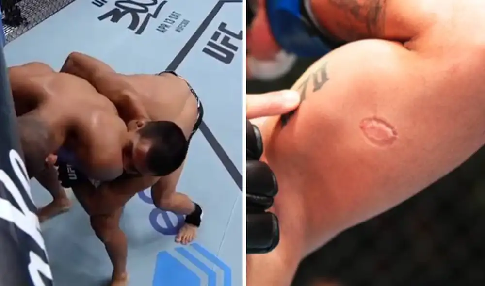 Igor Severino mordió a Andre Lima cuando faltaban más de 2 minutos para que acabe el segundo round. Foto: captura/ESPN Extra