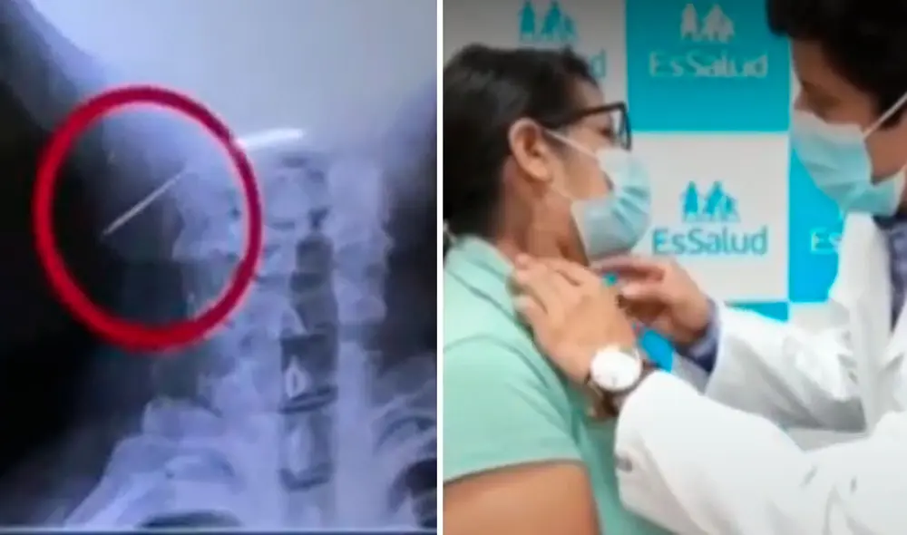 Intervención duró alrededor de 3 horas. Foto: composición LR/Canal N Intervención duró alrededor de 3 horas. Foto: composición LR/Canal N