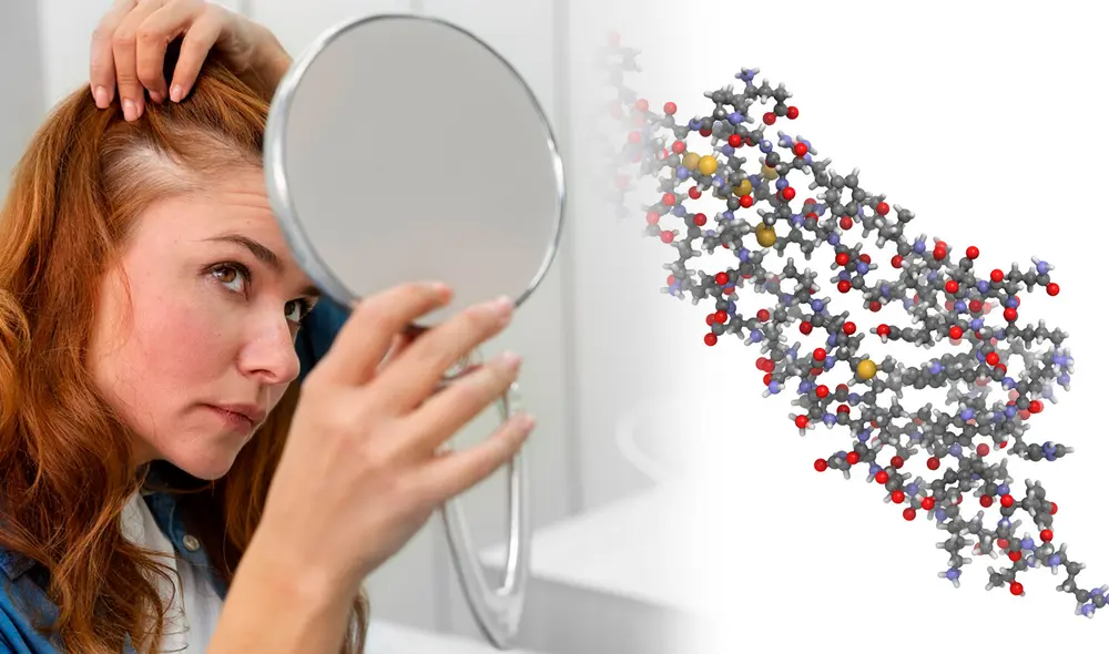 Científicos habrían acertado con la cura para la alopecia.