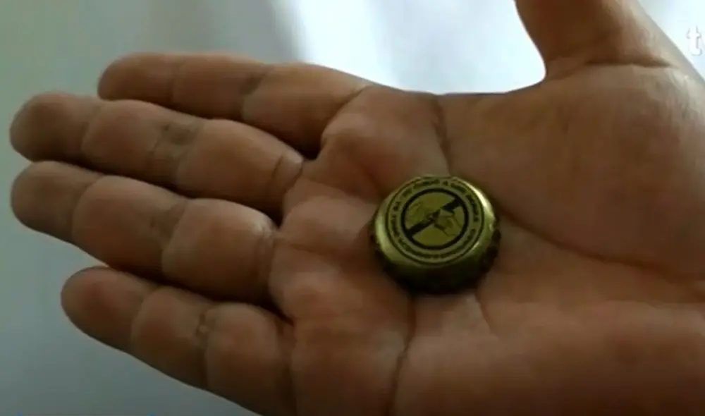 Operación fue exitosa porque se realizó a tiempo. Foto: TV Perú