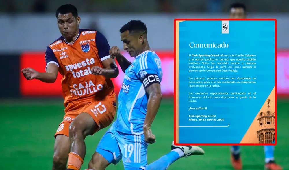 Yoshimar Yotún abandonó el partido a los 70 minutos tras una dura lesión. Foto: A Presión/Sporting Cristal