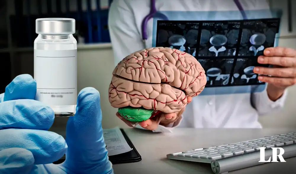 El glioblastoma es el tipo más común y agresivo de cáncer cerebral en adultos. Foto: composiciónLR/Freepik