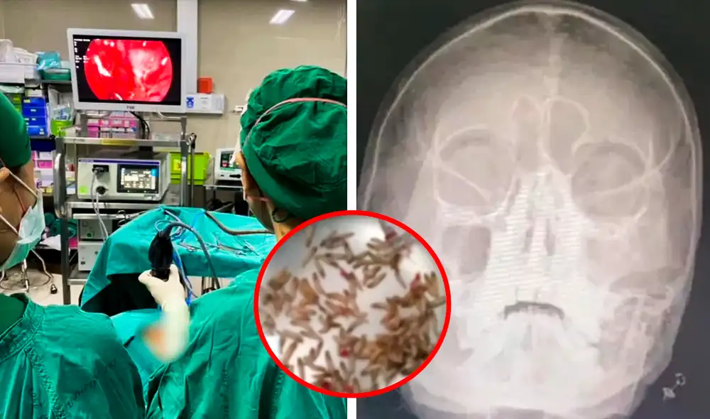 Una vez realizada la operación, lo médicos indicaron que la mujer dejó de sentir molestias en su rostro. Foto: Composición LR/The Mirror. Una vez realizada la operación, lo médicos indicaron que la mujer dejó de sentir molestias en su rostro. Foto: Composición LR/The Mirror.