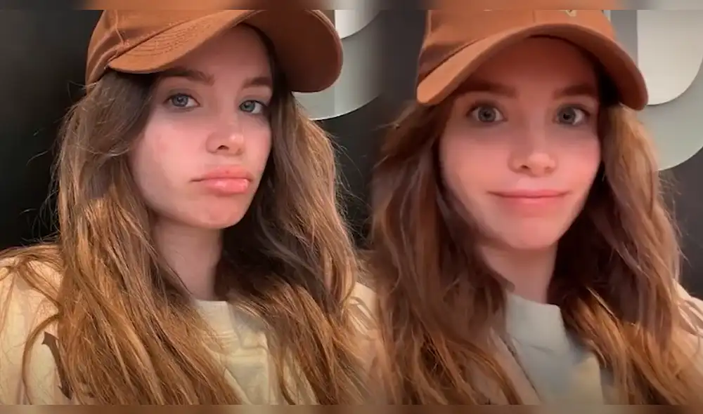 Flavia Laos respondió a sus seguidores acerca de las manchas en su rostro. Foto: Composición LR/Flavia Laos Instagram