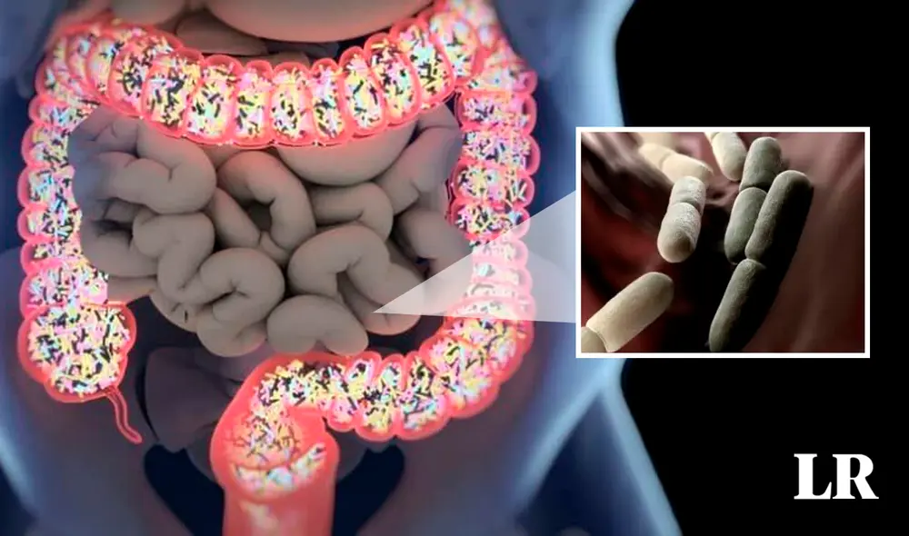 El síndrome de cervecería automática es una rara afección producida por un hongo en los intestinos. Foto: composiciónLR/Online Library/Pinterest