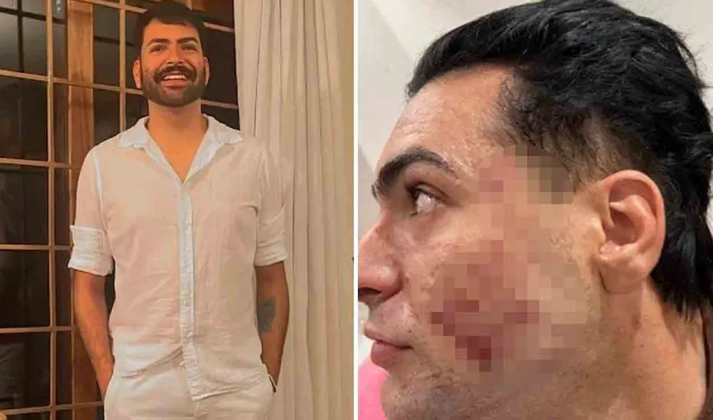 Natalia Becker, la influencer responsable del lugar donde ocurrió la tragedia, está siendo investigada por homicidio debido a la falta de autorización y las condiciones inseguras de su clínica. Foto: composición LR/Marcelo Camargo/Globo