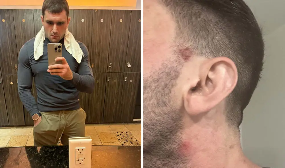 Joe DuPont, de 28 años, sufrió un diagnóstico erróneo en el Centro Médico Ronald Reagan, donde confundieron su sepsis con ansiedad. Foto: composición LR/JosephDDuPonT/Twitter Joe DuPont, de 28 años, sufrió un diagnóstico erróneo en el Centro Médico Ronald Reagan, donde confundieron su sepsis con ansiedad. Foto: composición LR/JosephDDuPonT/Twitter