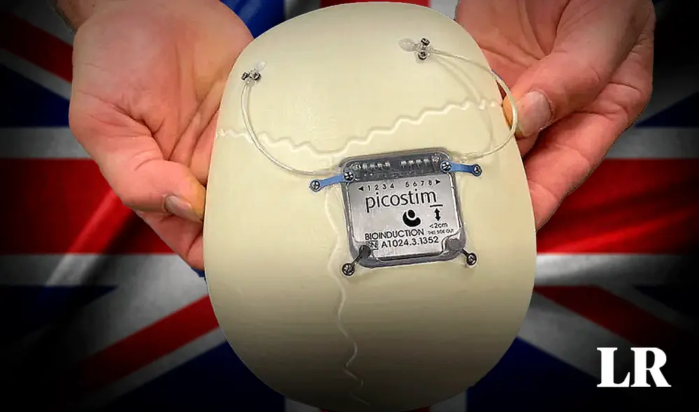 La operación duró aproximadamente 8 horas. Foto: composición LR/BBC/Vecteezy