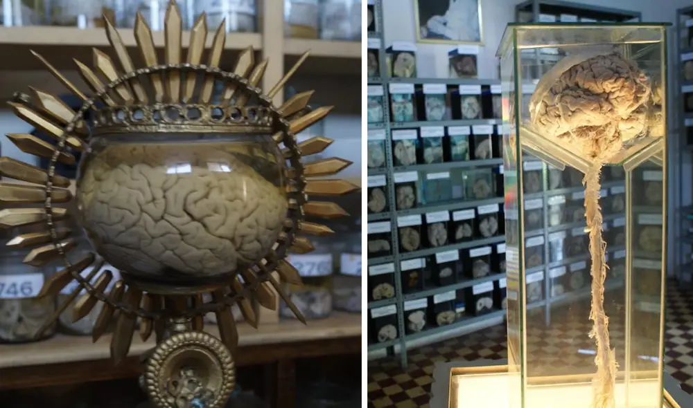 Este museo se encuentra ubicado en Barrios Altos. Foto: composición LR/Instituto Nacional de Ciencias Neurológicas/ UPC Este museo se encuentra ubicado en Barrios Altos. Foto: composición LR/Instituto Nacional de Ciencias Neurológicas/ UPC