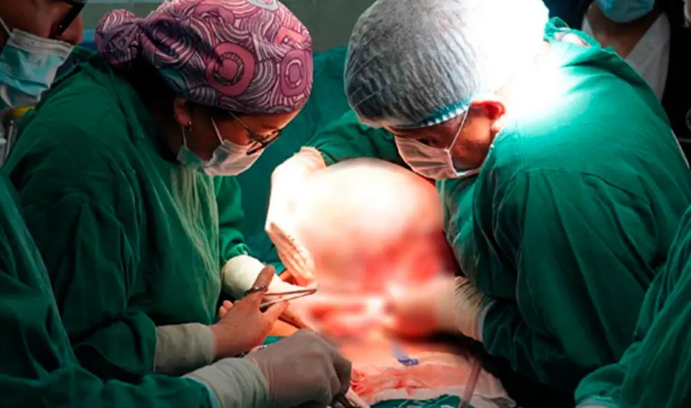 Los médicos lograron realizar una operación exitosa a la adulta mayor. Foto: Andina Los médicos lograron realizar una operación exitosa a la adulta mayor. Foto: Andina