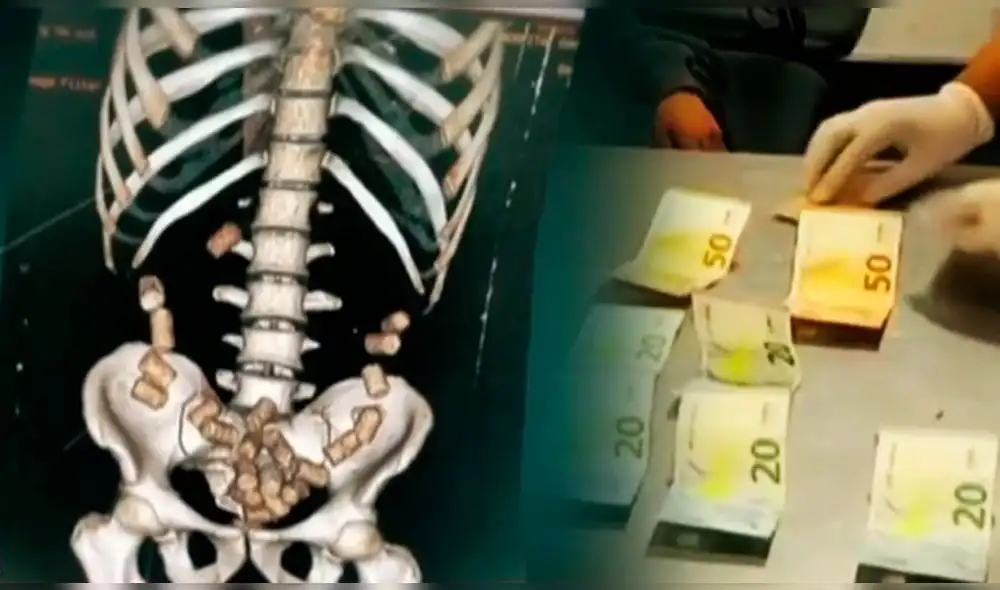 Uno de los burriers intervenidos llevaba cápsulas de cocaína en su estómago. Foto: captura Panamericana Uno de los burriers intervenidos llevaba cápsulas de cocaína en su estómago. Foto: captura Panamericana