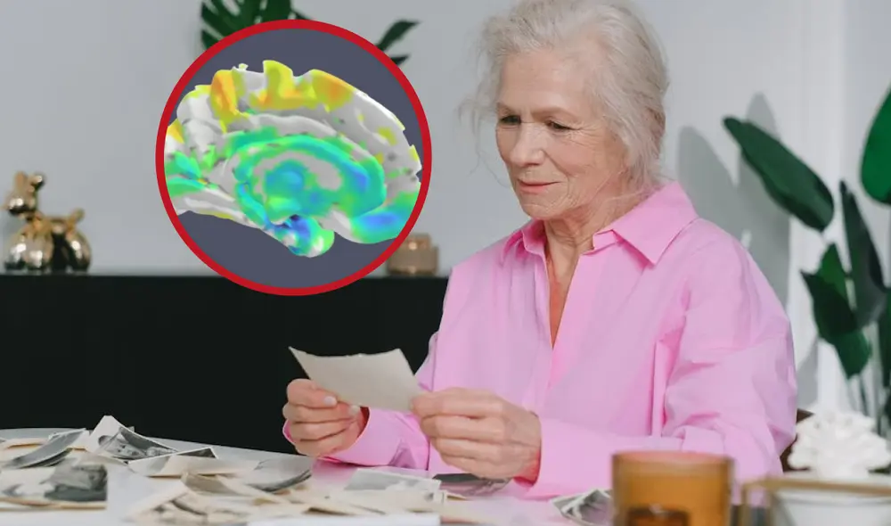 LANS avanza más lentamente que el Alzheimer. Foto: composición LR / Mayo Clinic / Pexels