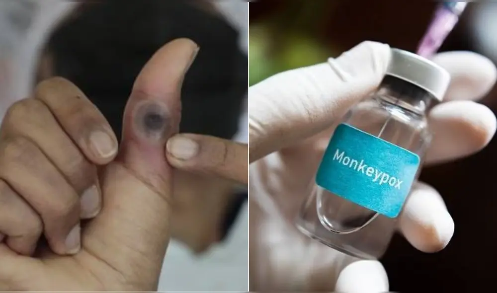 En Perú ya se vacuna contra la viruela del mono. Foto: Difusión
