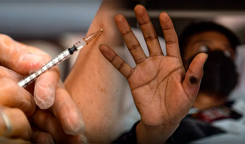 Existen dos vacunas frente a mpox. Foto: composición LR/AFP Existen dos vacunas frente a mpox. Foto: composición LR/AFP