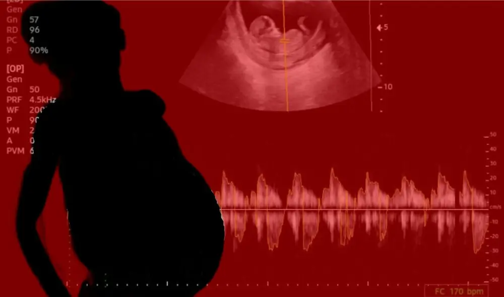 En un principio, los médicos creyeron que se trataba de un tumor. Foto: composición LR/Futureheal Co/difusión En un principio, los médicos creyeron que se trataba de un tumor. Foto: composición LR/Futureheal Co/difusión