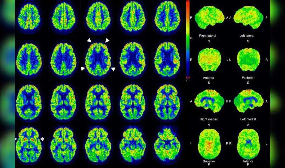 Este estudio tomó como muestra 353 adultos de diversos cetros de salud. Foto: La razón