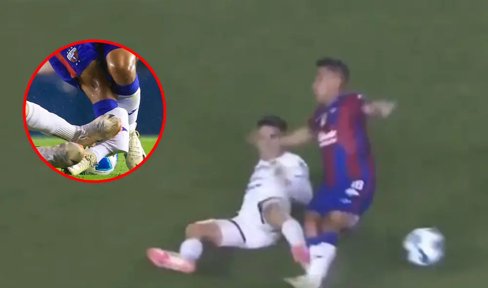 El jugador del Atlante tuvo que ser retirado en camilla tras la fuerte lesión sufrida. Foto: captura de ESPN