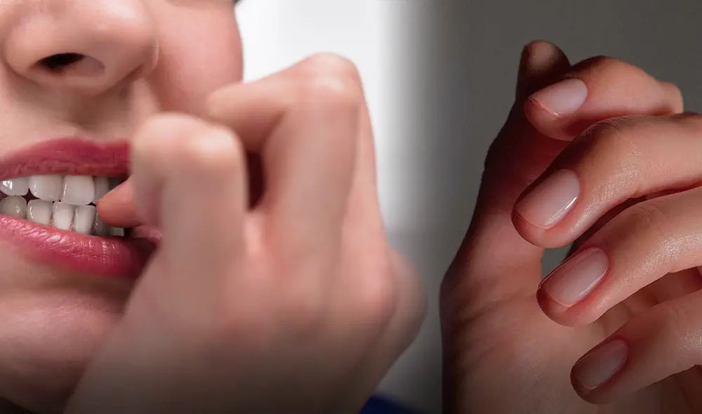 Comerse las uñas puede alterar la barrera de la piel humana, provocando graves infecciones. Foto: composición LR/Uno TV