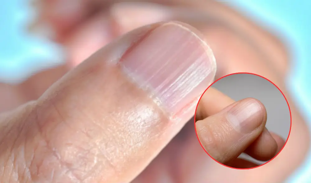 Esto es lo que dicen los expertos sobre tu estado de salud si tienes rayas en las uñas. Foto: composición LR/Clikisalud/Yahoo