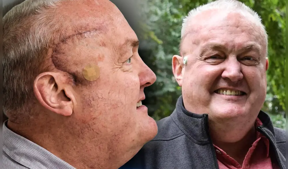 El glioblastoma es uno de los tipos de cáncer cerebral más agresivos y difíciles de tratar. Foto: Composición LR/UCLH.