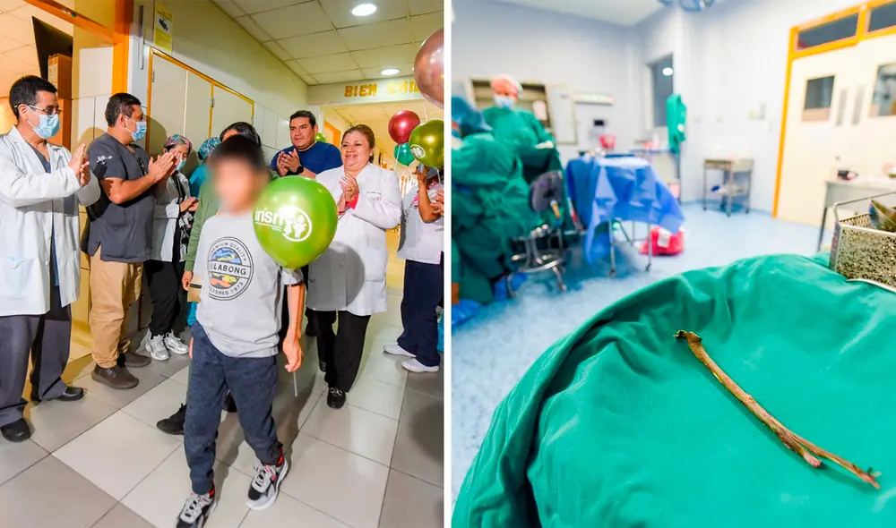 El menor fue dado de alta casi una semana después de la intervención. Foto: composición LR/INS El menor fue dado de alta casi una semana después de la intervención. Foto: composición LR/INS