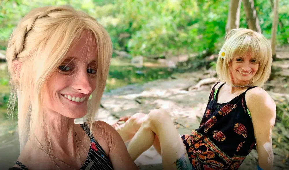 Esta mujer padece un trastorno genético conocido como síndrome de progeria. Foto: composición LR/X