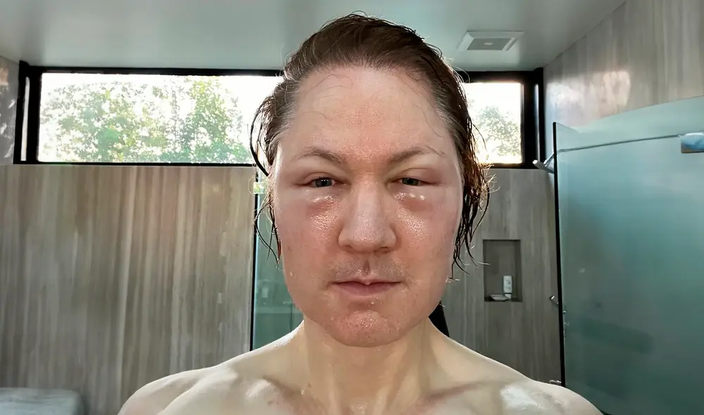 La reacción extrema en el rostro del multimillonario fue causada por los procedimientos poco convencionales. Foto: People.