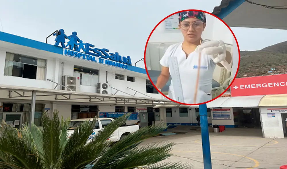 Menor de dos años continúa en observación luego de expulsar una lombriz intestinal de más de 40 cm/Composición LR/Foto: Andina Menor de dos años continúa en observación luego de expulsar una lombriz intestinal de más de 40 cm/Composición LR/Foto: Andina