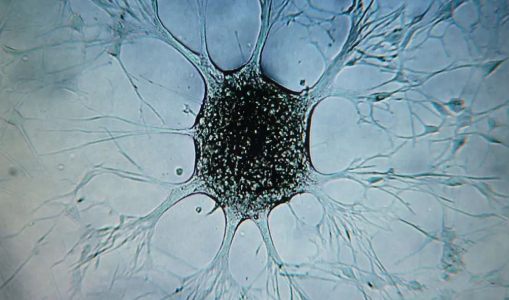 La proteína p62 podría utilizarse como marcador pronóstico en tumores con alta inestabilidad cromosómica, ayudando a identificar tipos de cáncer más agresivos. Foto: ANSA