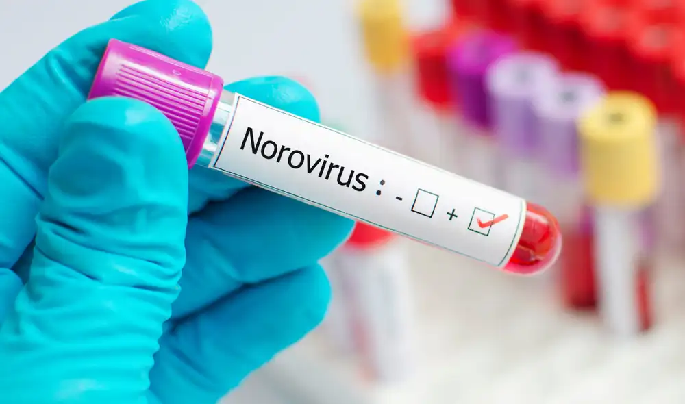 El norovirus es una bacteria que se ha expandido por Estados unidos. Foto: difusión