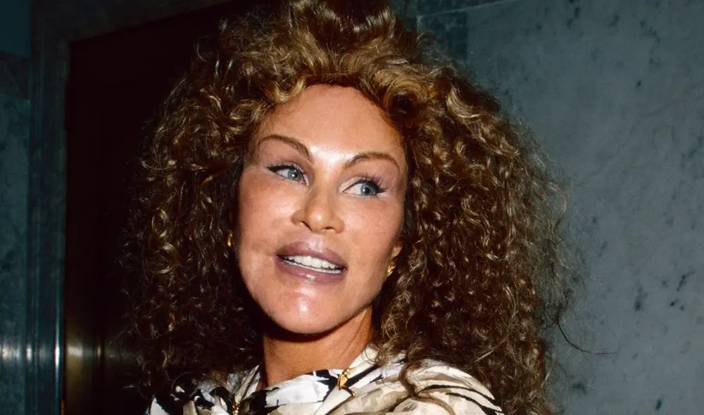 'Catwoman' comenzó un largo camino de las cirugías estéticas un año después de casarse con el multimillonario Alec Wildenstein. Foto: CNN.