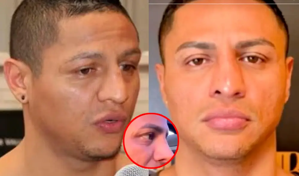 Jonathan Maicelo anunció su operación a la nariz a finales del 2024. Foto: Composición LR/Captura/TikTok