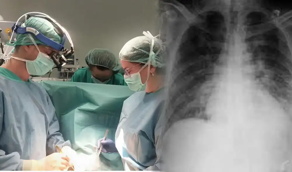 Los cirujanos cardíacos infantiles del Chuac realzaron una reversión de cardiopatía fulminante en una niña