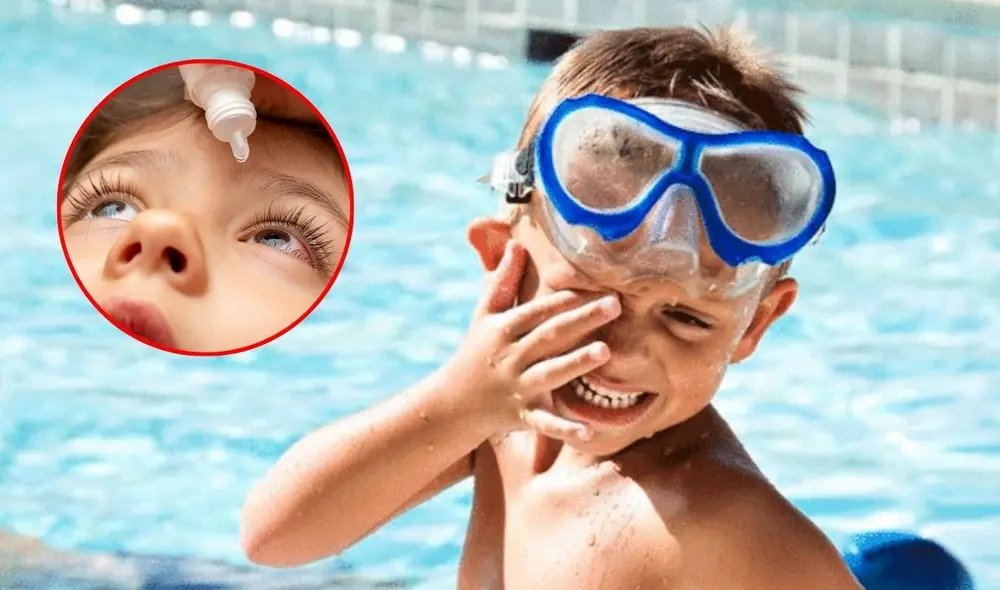 La conjuntivitis es una afección frecuente en verano que puede evitarse con medidas de higiene y prevención adecuadas. Foto: composición LR