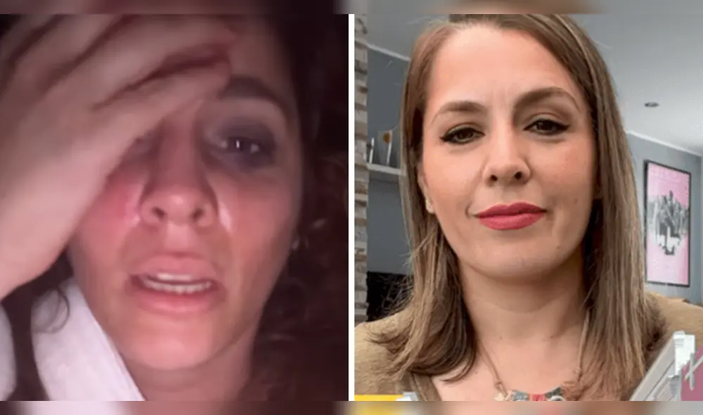 Yiddá Eslava revela en Instagram que sufrió un accidente en el set de filmación. Foto: Composición LR/Instagram