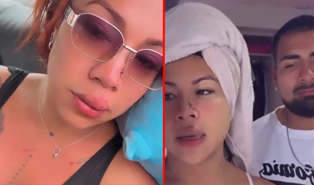 Dayanita desmiente aparente agresión de su novio. Foto: Instagram