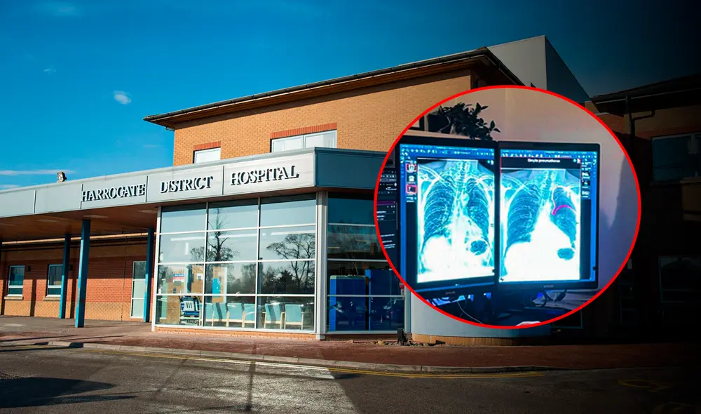 Financiado por el Fondo de Diagnósticos de IA del NHS, se espera reducir errores humanos y mejorar la eficiencia operativa en radiología. Foto: composición LR/Harrogate and District NHS Foundation Trust. Financiado por el Fondo de Diagnósticos de IA del NHS, se espera reducir errores humanos y mejorar la eficiencia operativa en radiología. Foto: composición LR/Harrogate and District NHS Foundation Trust.