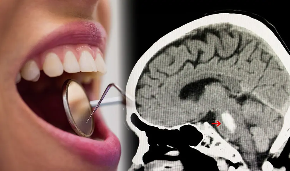 Las investigaciones más recientes sugieren que las bacterias que viven en la lengua y las encías pueden afectar el funcionamiento del cerebro. Foto: Pexels