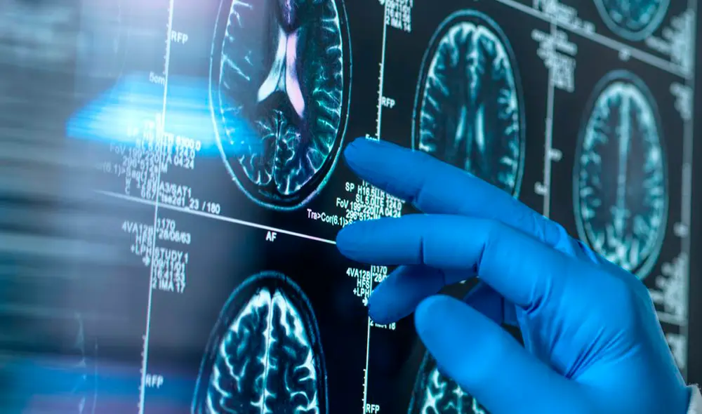 La infección parasitaria provocó una inflamación en el cerebro de la paciente y afectó su sistema nervioso central. Foto: difusión