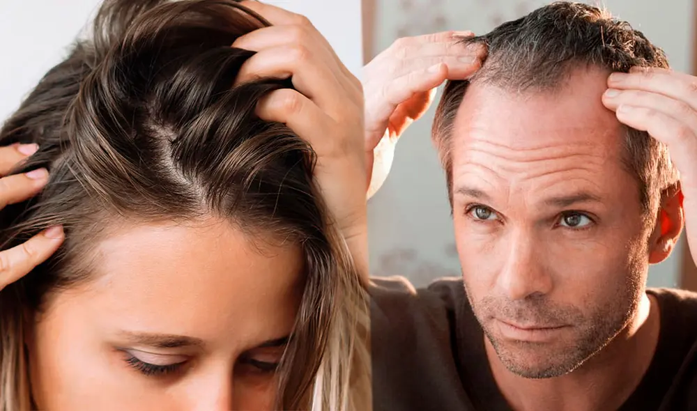 "Las personas suelen perder de 50 a 100 hebras de cabello al día", dijo Mayo Clinic. Foto: Composición LR/Clinica de Tratamiento Capilar/Primor