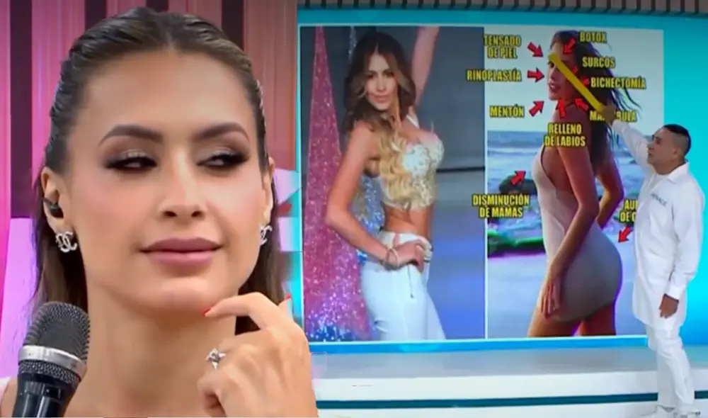 Milett Figueroa aseguró que no se ha sometido a ninguna operación estética. Foto: composición LR/América TV