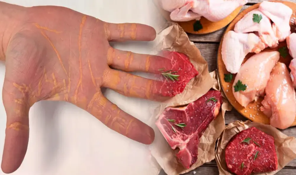 Médicos recomiendan tener una supervisión de especialistas a momento de seguir dietas extremas. Foto: JAMA Cardiology