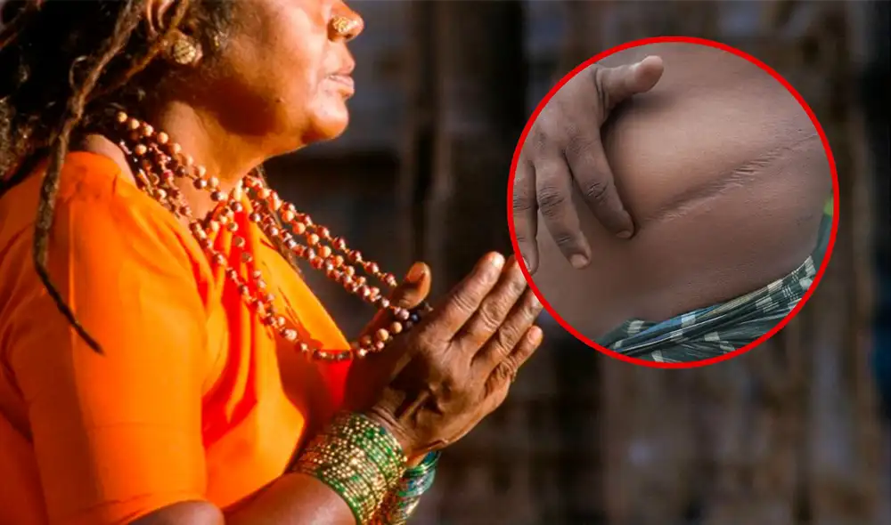 La mujer logró convencer a su esposo para realizarse la cirugía, pero durante su recuperación huyó con el dinero. Foto: composición LR / X / AFP