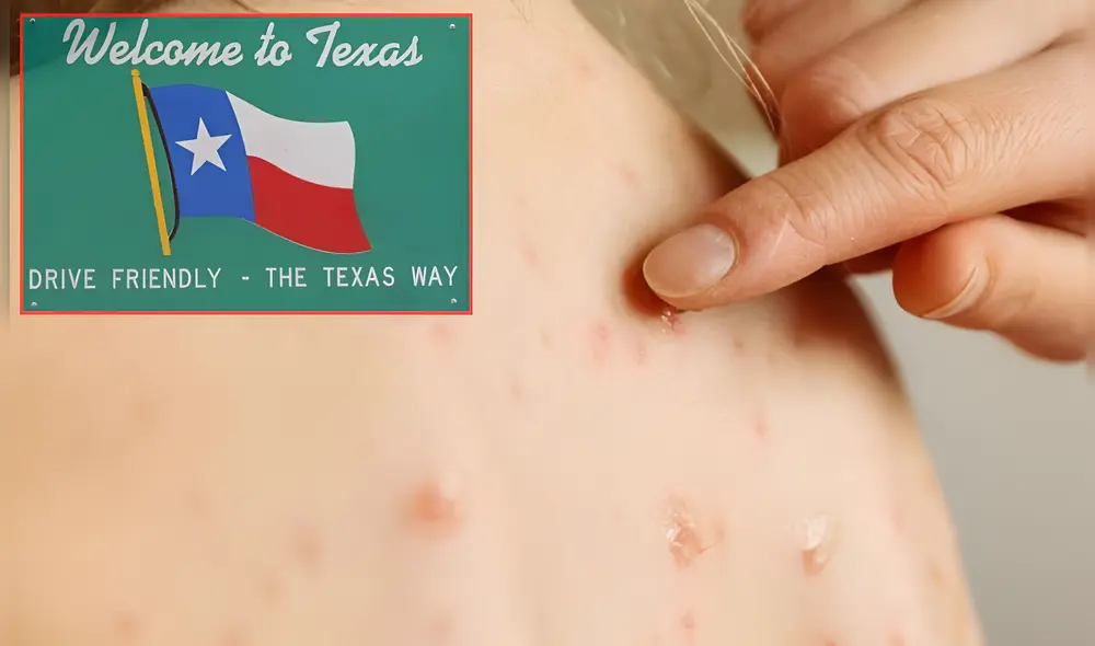 Gaines es uno de los condados más afectados por el sarampión en Texas. Foto: Composición LR/Google/iStock