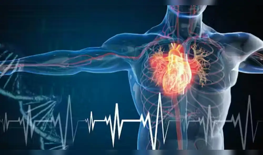 Síntomas de un infarto.