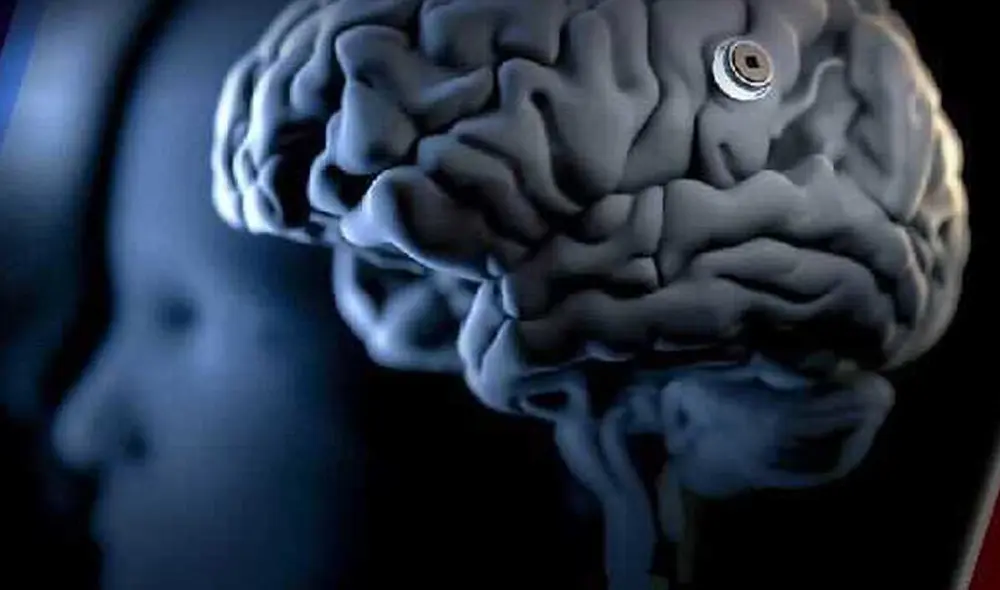 Científicos plantean dispositivo digital para tratar enfermedades cerebrales. Foto: CNN