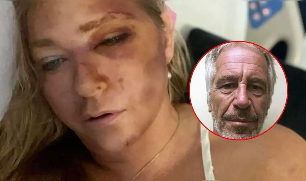 Virginia Giuffre enfrenta un grave estado de salud tras un accidente automovilístico. Foto: composición LR/difusión. Virginia Giuffre enfrenta un grave estado de salud tras un accidente automovilístico. Foto: composición LR/difusión.