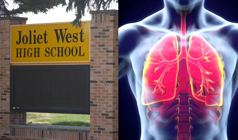 Los funcionarios de salud en Chicago recomiendan que las personas que estuvieron en contacto cercano consulten a un médico para hacerse una prueba. Foto: Shaw Local/Infosalus