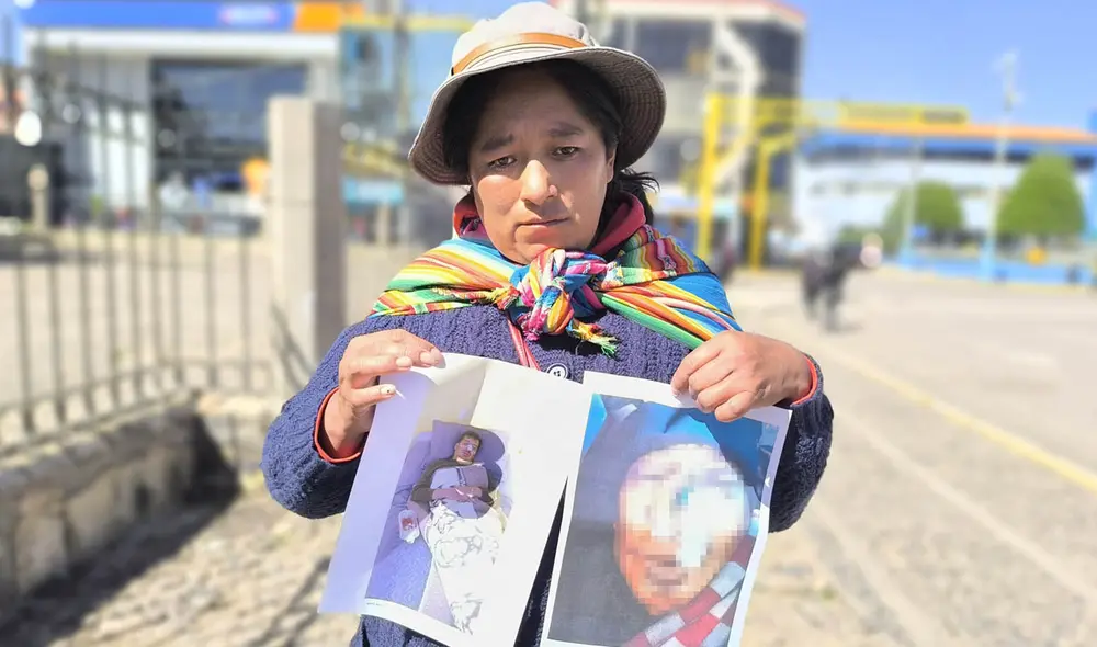 Esposa de minero señaló que requiere dos operaciones más. Foto: Cinthia Álvarez - La República. Esposa de minero señaló que requiere dos operaciones más. Foto: Cinthia Álvarez - La República.